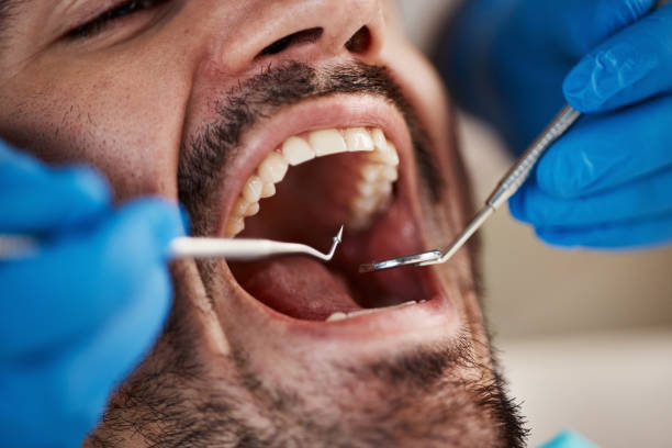 Best Emergency Broken Tooth Repair in Centre Hall, PA