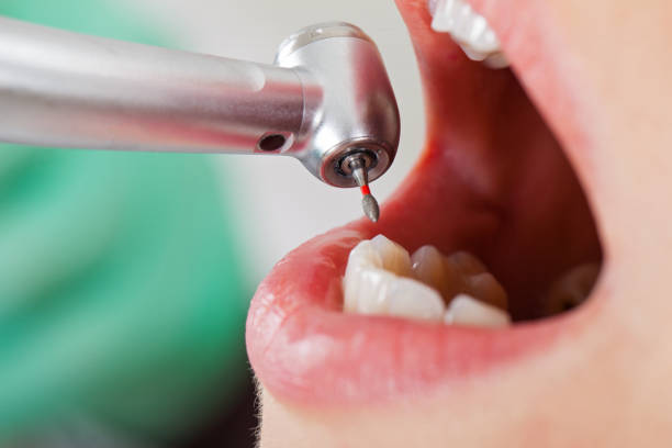 Best Emergency Wisdom Teeth Removal in Centre Hall, PA